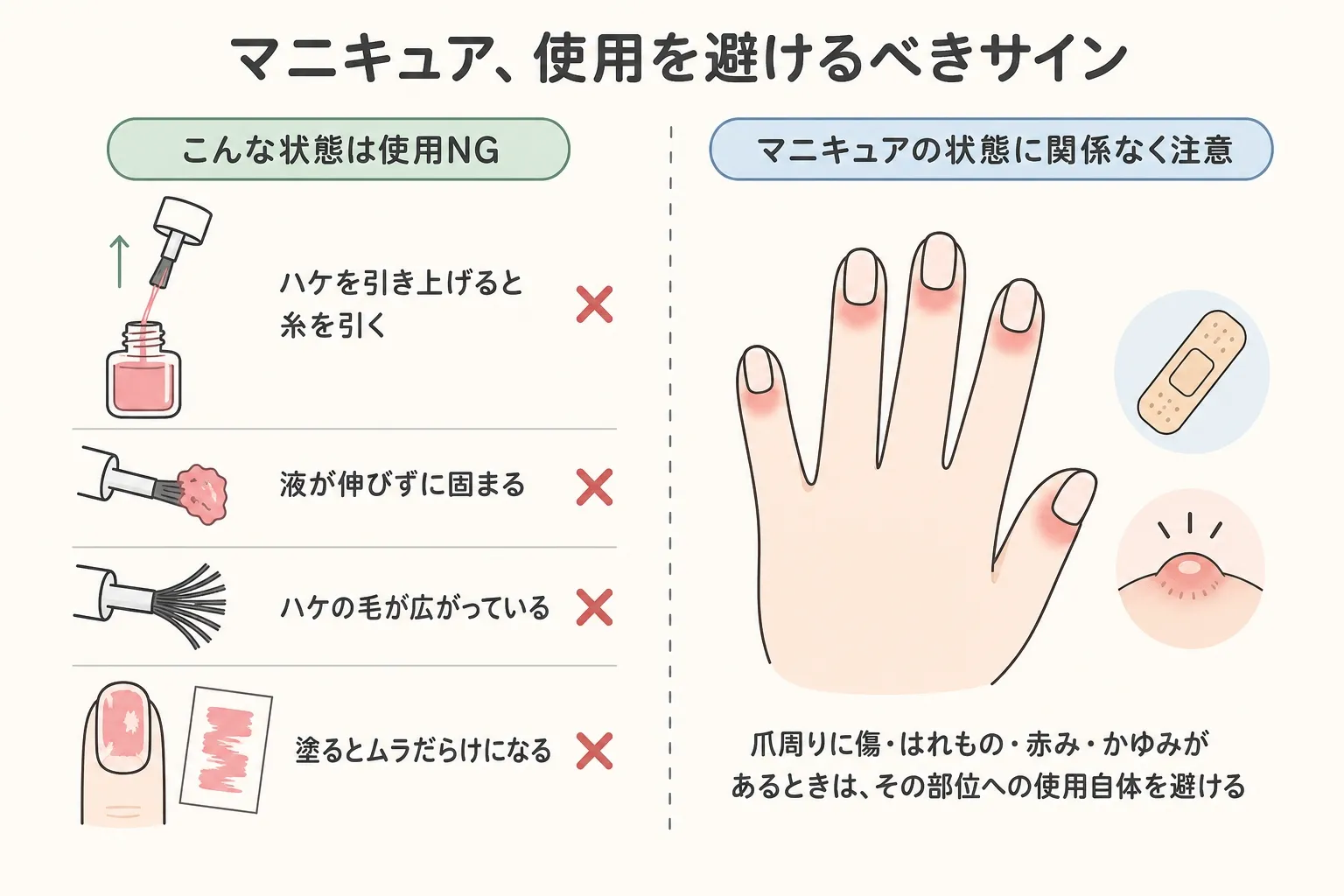 マニキュアの使用を避けるべきサインを説明する医療系のインフォグラフィック。劣化したマニキュアの症状4つと、爪周りの傷や炎症がある場合の注意を示す。